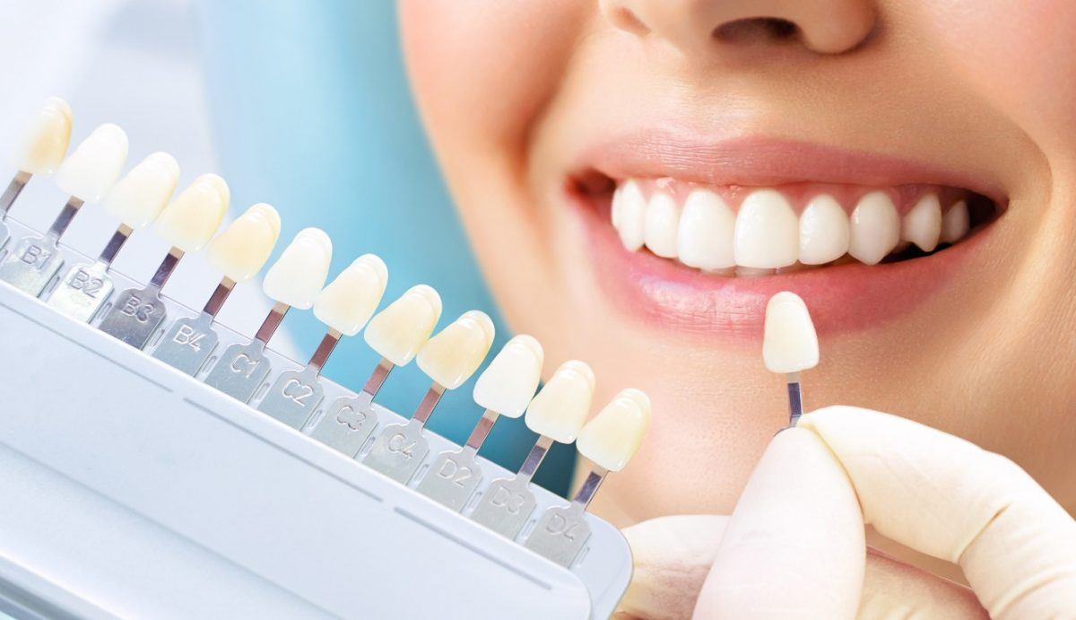 Estética Dental